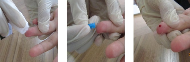 血痕采样方法 